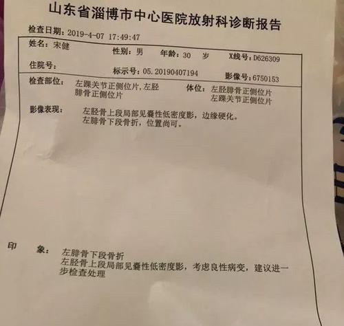 足球侧位防守技巧详解（如何通过侧位防守提高足球比赛中的防守效果）